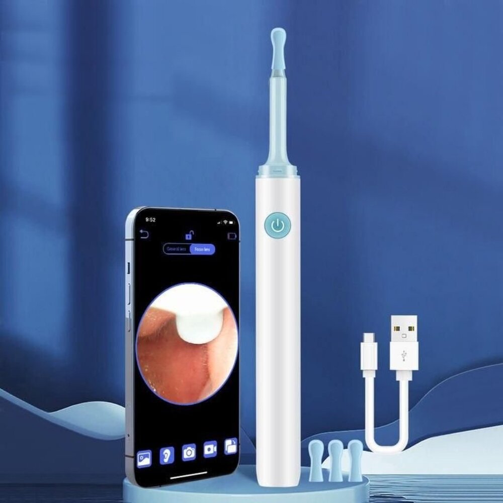 Wireless 3.9mm HD Ear Camera: Luminous Ear Cleaner & Otoscope - Picture 3 of 5